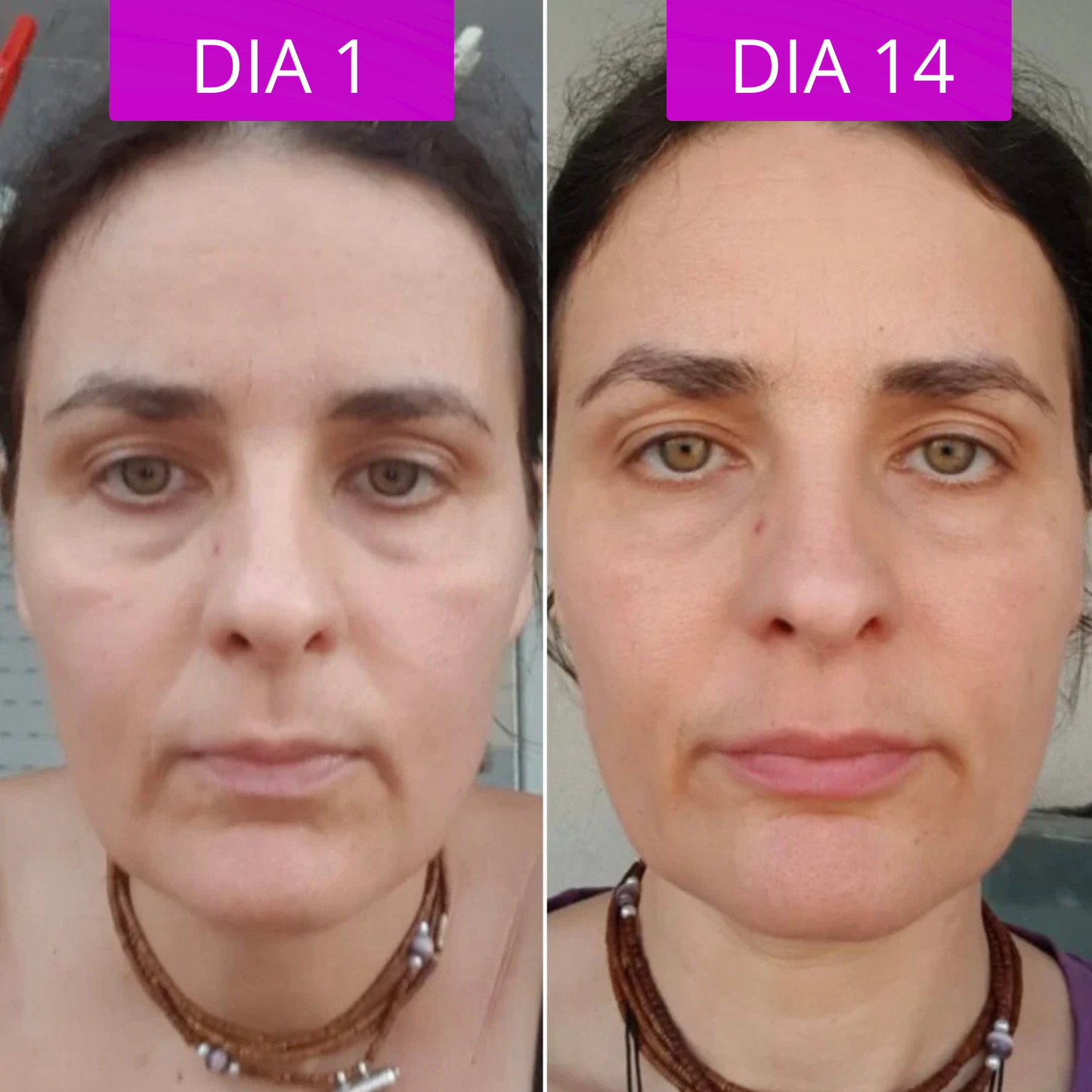 Bálsamo Coreano Efeito Lifting - Dr.Melaxin